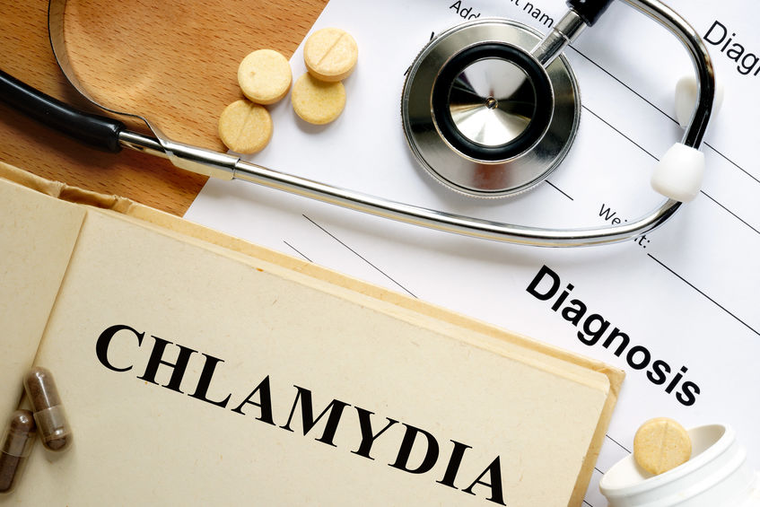 same day chlamydia test, immediate chlamydia test results