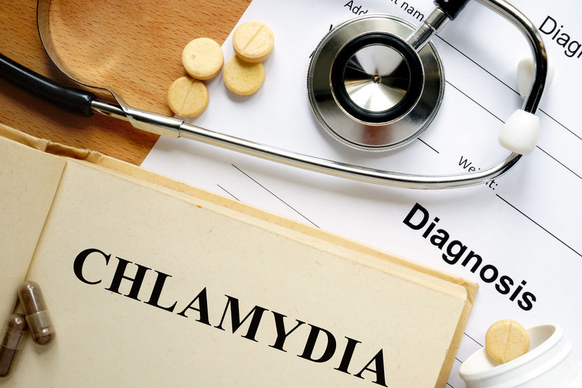 Chlamydia: Symptoms in Men and Women, Causes, and Cure