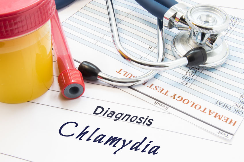 Chlamydia treatment, immediate chlamydia test results