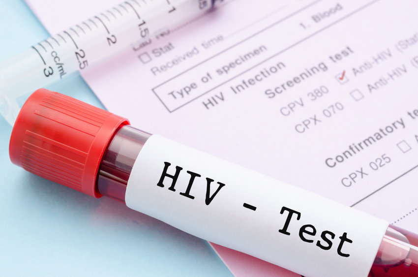free HIV testing facility in DC, HIV testing in Arlington VA